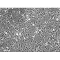 Rat Lung Fibroblasts-adult (RLuF-a)